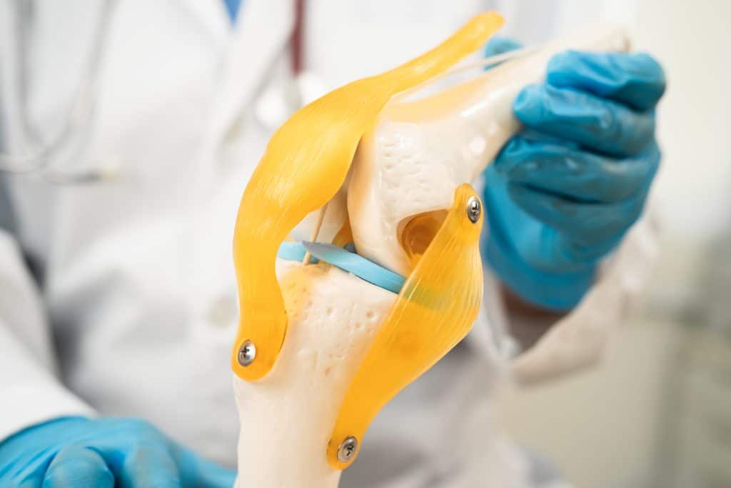 osteoarthritis of the knee doctor holding human k 2025 02 25 23 18 17 utc